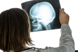 Doctor analyzing human skull x-ray screening image in hospital office during medical exam