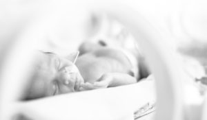 newborn baby girl in the hospital incubator after c-section in 33 week