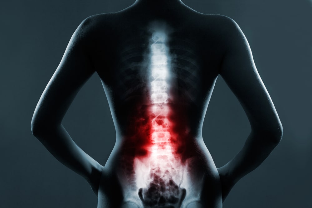 spinal injury lawyer